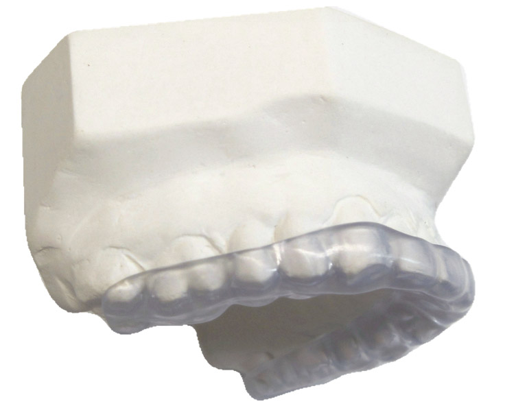 Night Guards / Occlusal Splint Carlton Dental Care